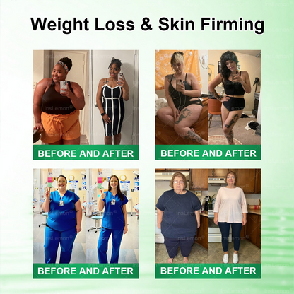 𝐈𝐧𝐬𝐋𝐞𝐦𝐨𝐧® 𝗠𝗼𝗿𝗶𝗻𝗴𝗮 × 𝗕𝗲𝗿𝗯𝗲𝗿𝗶𝗻𝗲 × 𝗔𝗠𝗣𝗞 𝟭𝟬-𝗶𝗻-𝟭 𝗠𝗲𝘁𝗮𝗯𝗼𝗹𝗶𝗰 𝗦𝘂𝗽𝗽𝗼𝗿𝘁 𝗡𝗮𝗻𝗼 𝗠𝗶𝗰𝗿𝗼𝗻𝗲𝗲𝗱𝗹𝗲 𝗣𝗮𝘁𝗰𝗵🇨🇦(𝐉𝐮𝐬𝐭 𝐨𝐧𝐜𝐞 𝐚 𝐝𝐚𝐲, 𝐯𝐢𝐬𝐢𝐛𝐥𝐞 𝐜𝐡𝐚𝐧𝐠𝐞𝐬 𝐢𝐧 𝟕 𝐝𝐚𝐲𝐬） ✅ 𝐅𝐨𝐫 𝐨𝐛𝐞𝐬𝐢𝐭𝐲, 🅛🅞🅞🅢🅔 🅢🅚🅘🅝,𝐝𝐢𝐚𝐛𝐞𝐭𝐞𝐬, 𝐬𝐥𝐞𝐞𝐩 𝐚𝐩𝐧𝐞𝐚, 𝐣𝐨𝐢𝐧𝐭 𝐢𝐬𝐬𝐮𝐞𝐬, 𝐚𝐧𝐝 𝐦𝐨𝐫𝐞