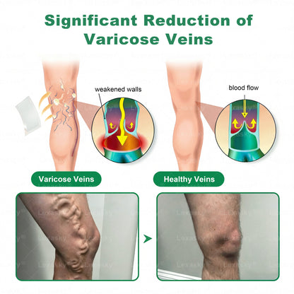 👨‍⚕️✅✅𝐋𝐞𝐱𝐚𝐬𝐤𝐲® 𝐕𝐞𝐢𝐧 𝐓𝐚𝐫𝐠𝐞𝐭 𝐌𝐢𝐜𝐫𝐨𝐧𝐞𝐞𝐝𝐥𝐞 𝐏𝐚𝐭𝐜𝐡⚡Instant Relief, Long-Term Results big sale